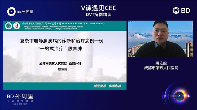 复杂下肢静脉疾病的诊断和治疗病例一例&ldquo;一站式治疗&rdquo;股青肿-姚佐懿