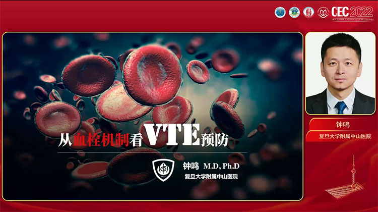 从血栓机制看VTE预防-钟鸣