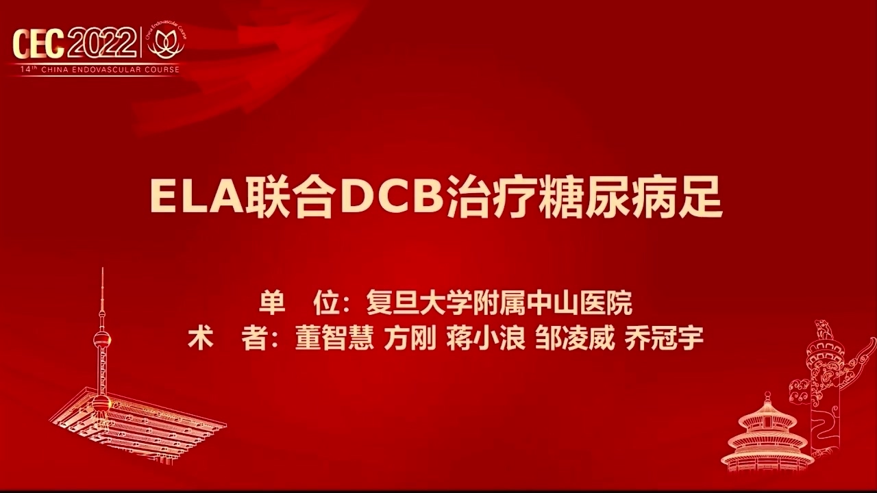 ELA联合DCB治疗糖尿病足-董智慧 方刚