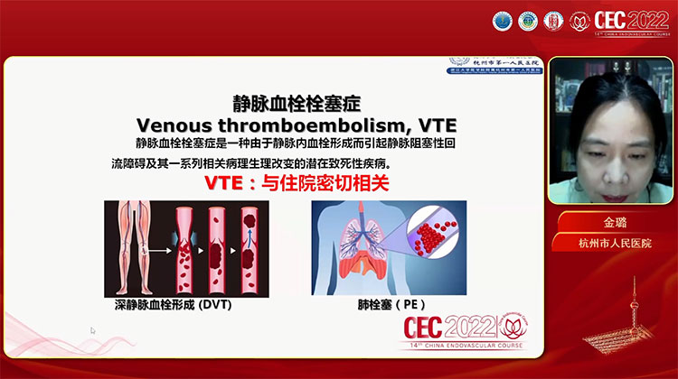 VTE的院内早期识别和基础预防-金璐