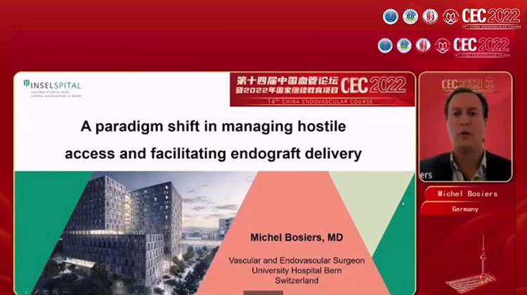 管理困难入路和促进支架输送的思维模式转变-A-paradigm-shift-in-managing-hostile-access-and-facilitating-endograft-delivery-Michel-Bosiers