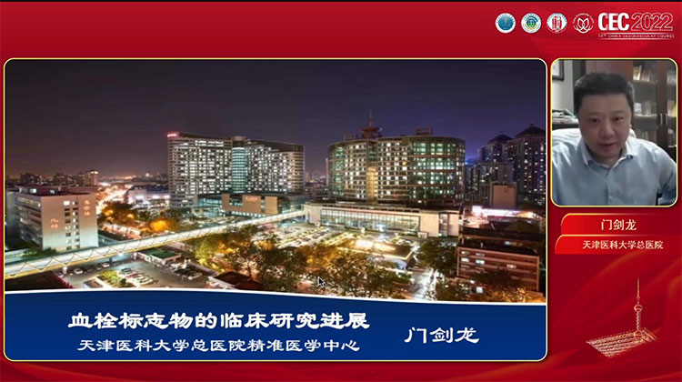 血栓标志物的临床研究进展-门剑龙