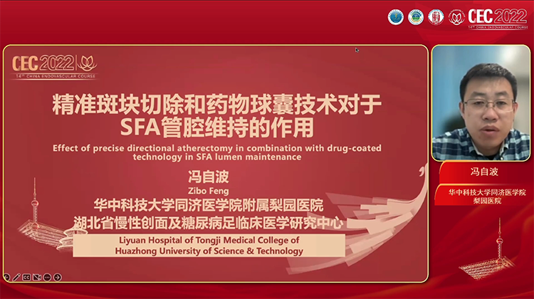 精准斑块切除和药物球囊技术对于SFA管腔维持的作用-冯自波