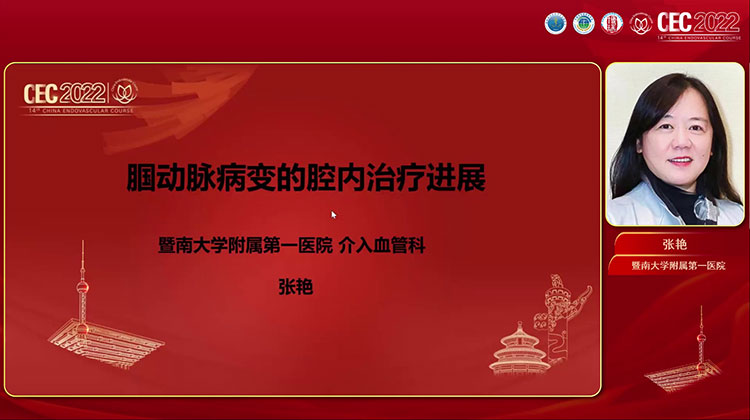 腘动脉病变腔内治疗进展-张艳