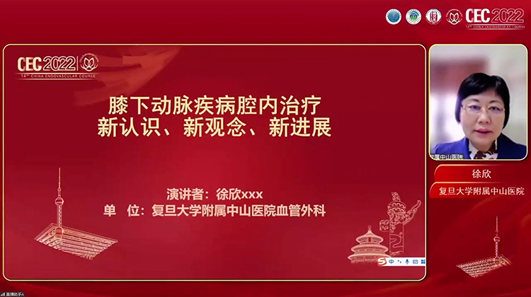 膝下动脉疾病腔内治疗新认识、新观念、新进展-徐欣