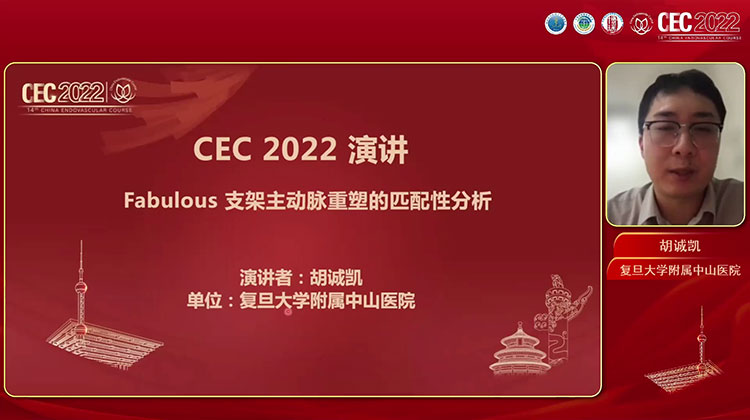 Fabulous支架主动脉重塑的匹配性分析-胡诚凯