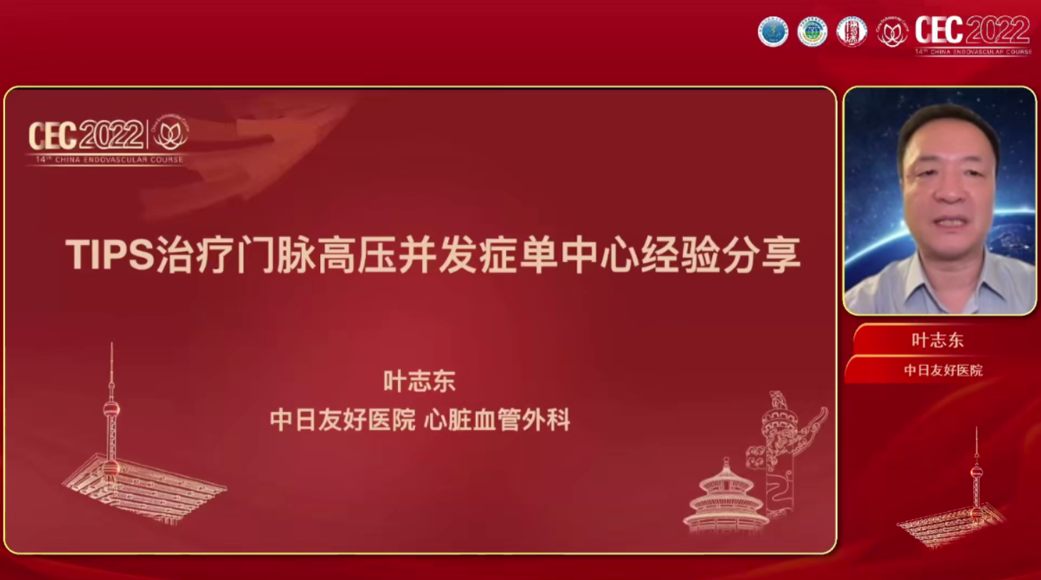 TIPS治疗门脉高压并发症单中心经验分享-叶志东