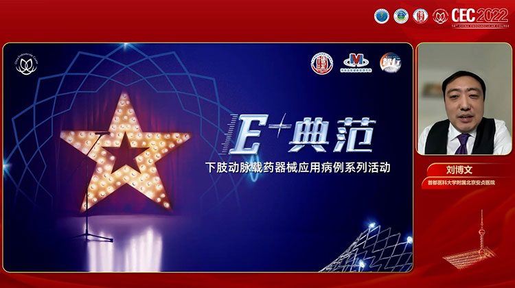 股浅动脉慢性重度钙化病变的杂交治疗-刘博文