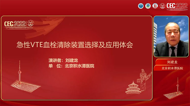 急性VTE血栓清除装置选择及应用体会-刘建龙