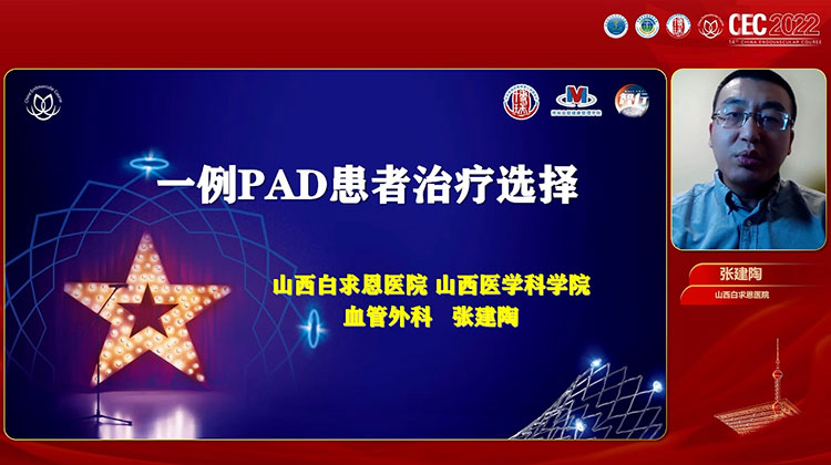 一例PAD患者治疗选择-张建陶