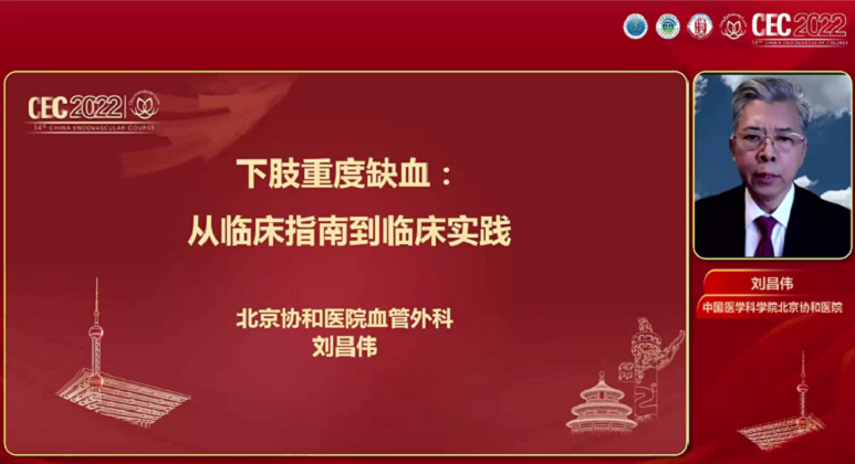 重症下肢缺血：从临床指南到临床实践-刘昌伟