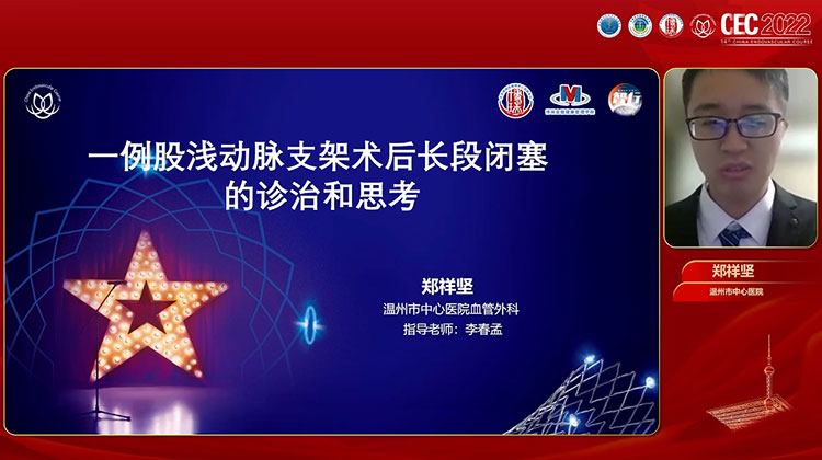 一例股浅动脉支架术后长段闭塞的诊治和思考-郑祥坚