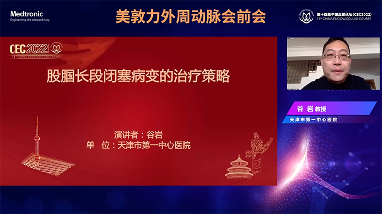 股腘长段闭塞病变的治疗策略-谷岩