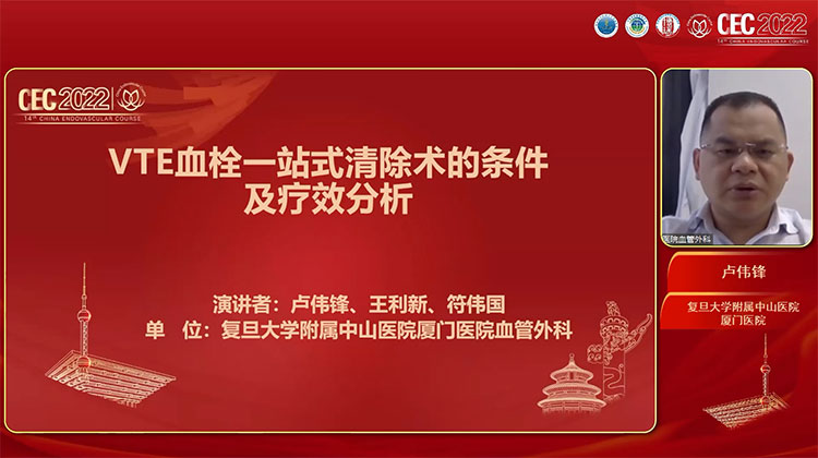 VTE血栓一站式清除术的条件及疗效分析-卢伟锋