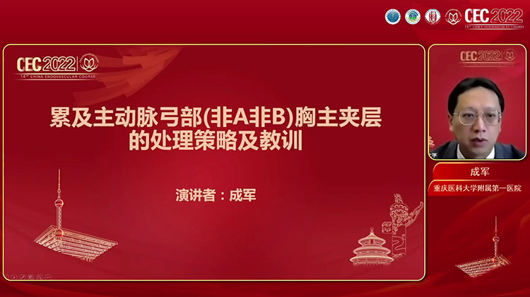 累及主动脉弓部的胸主夹层处理策略及教训-成军