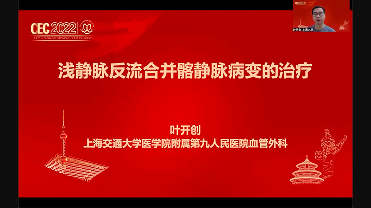 浅静脉反流合并髂静脉病变的治疗-叶开创