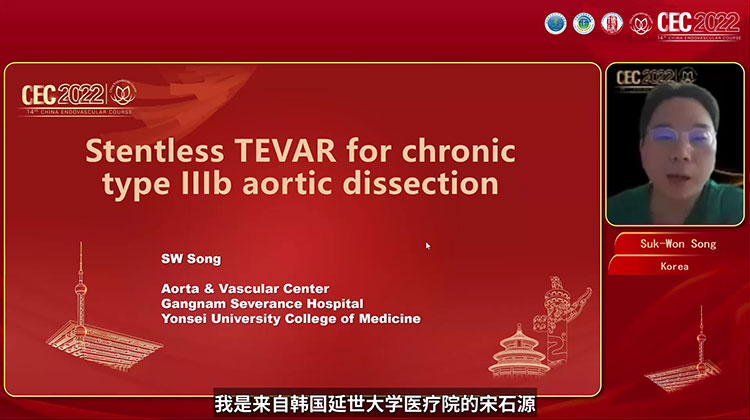 无支架的胸主动脉腔内修复术（TEVAR）治疗慢性B型主动脉夹层 Stentless TEVAR for Chronic type IIIb aortic dissection-Suk-Won Song