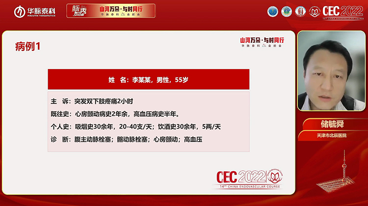 溶栓导管在下肢血管血栓性病变中的应用-储毓舜