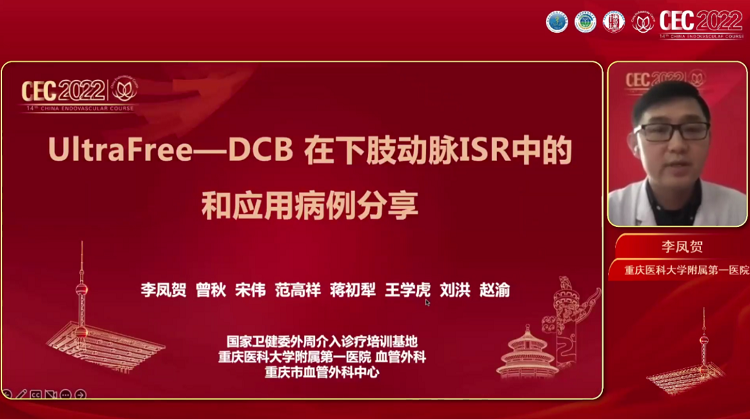 UltraFree&reg;在下肢动脉的治疗应用-李凤贺