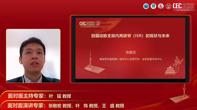 股腘动脉支架内再狭窄（ISR）的现状与未来-张敏宏