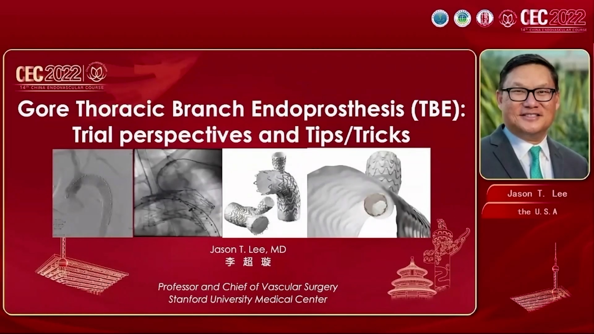 Thoracic Branch Endoprosthesis Experience and Outcomes-Jason T. Lee