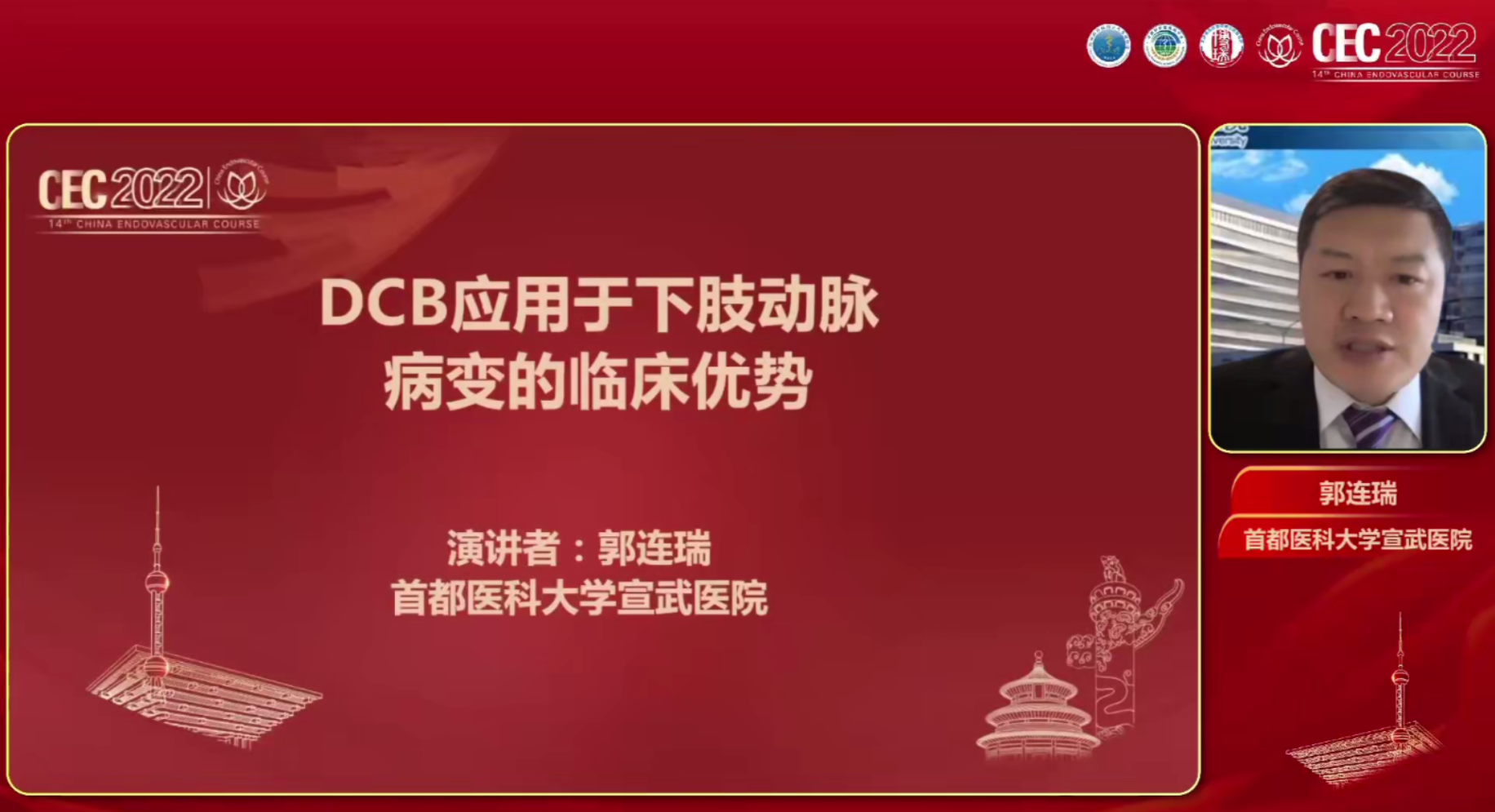 DCB应用于下肢动脉病变的临床优势-郭连瑞
