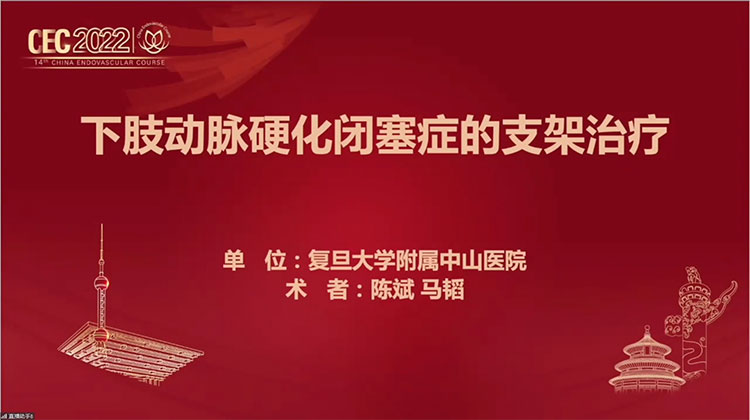 下肢动脉硬化闭塞症的支架治疗-陈斌，马韬