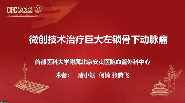 微创技术治疗巨大左锁骨下动脉瘤-陈忠-唐小斌