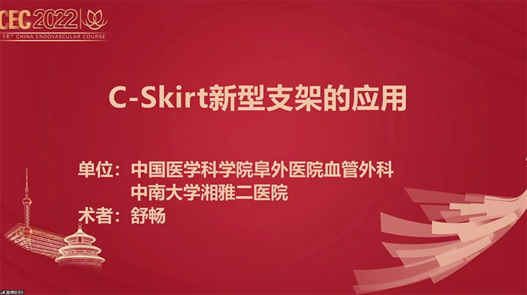 C-Skirt新型支架的应用-舒畅 