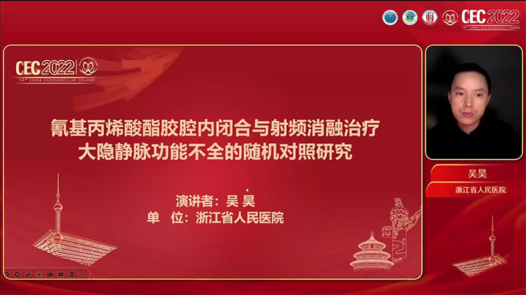氰基丙烯酸酯胶腔内闭合与射频消融治疗大隐静脉功能不全的随机对照研究-吴昊