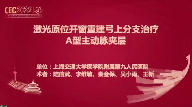 激光弓上三开窗-陆信武