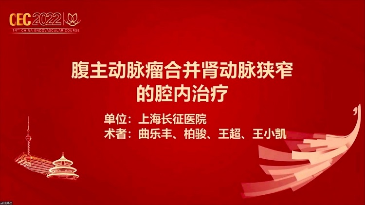 InCraft 腹主动脉瘤合并肾动脉狭窄的腔内治疗-曲乐丰
