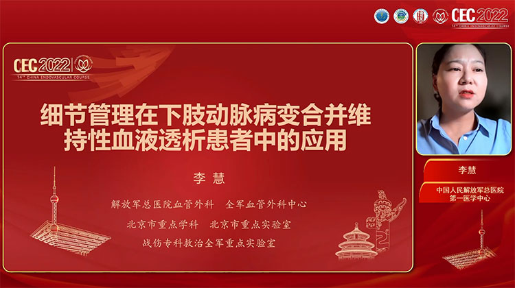 细节管理在下肢动脉病变合并维持性血液透析患者中的应用-李慧