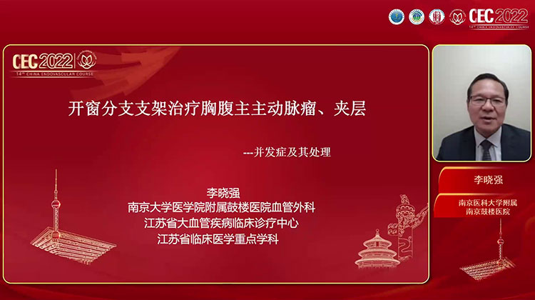 开窗分支支架技术治疗胸腹主动脉瘤的并发症-李晓强
