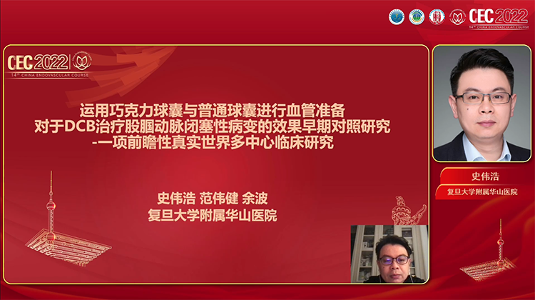 运用巧克力球囊与普通球囊进行血管准备对于DCB治疗股腘动脉闭塞性病变的效果早期对照研究一项前瞻性真实世界多中心临床研究-史伟浩