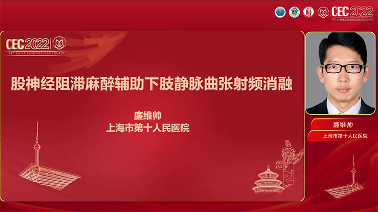 股神经阻滞麻醉辅助下肢静脉曲张射频消融-廉维帅