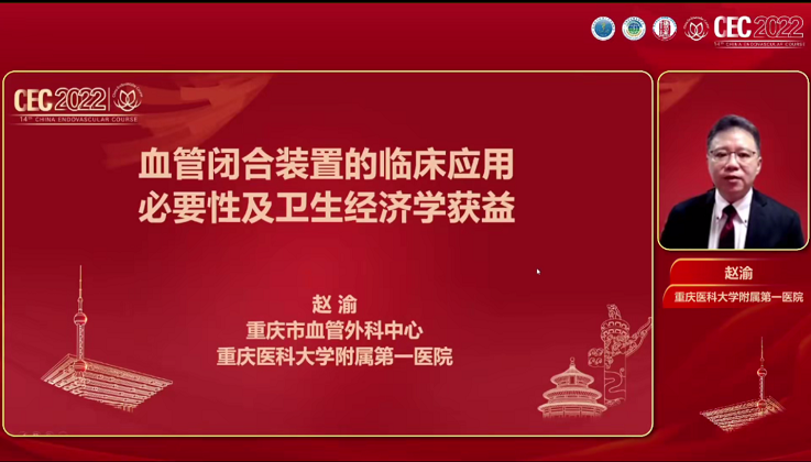 血管闭合装置的临床使用必要性及卫生经济学获益-赵渝