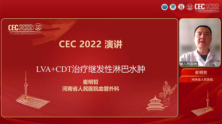 LVA+CDT治疗继发性淋巴水肿-崔明哲