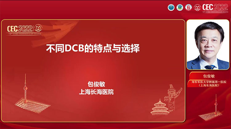 不同DCB的特点与选择-包俊敏