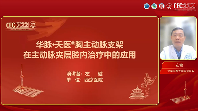 华脉&middot;天医&reg;胸主动脉支架在主动脉夹层腔内治疗中的应用-左健