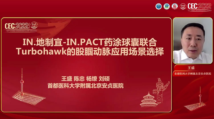 IN.地制宜-IN.PACT药涂球囊联合Turbohawk的股腘动脉应用场景选择-王盛