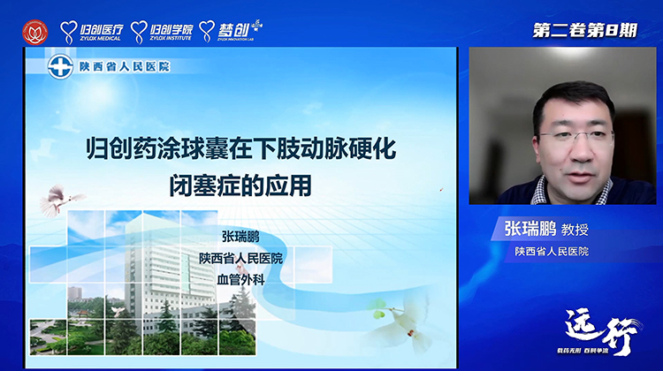 归创药涂球囊在下肢动脉硬化闭塞症的应用-张瑞鹏