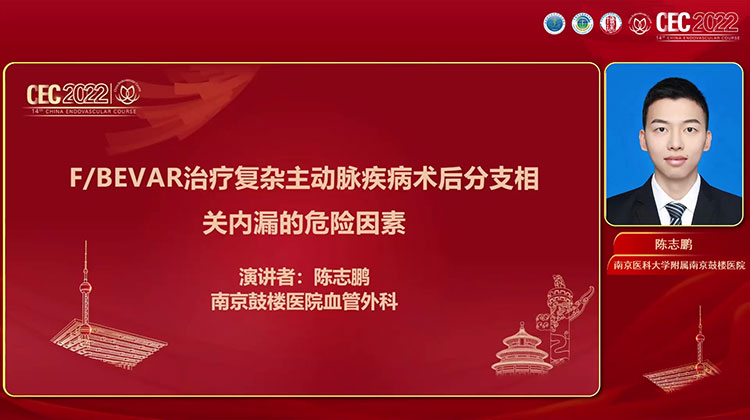 夹层动脉瘤患者内脏区开窗与分支支架术后分支相关内漏危险因素-陈志鹏