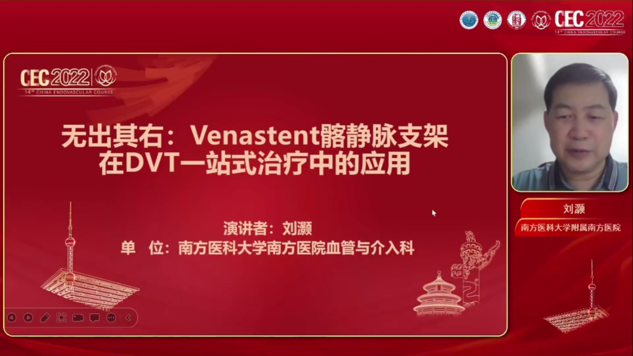 IVCS合并DVT的病例分享-刘灏