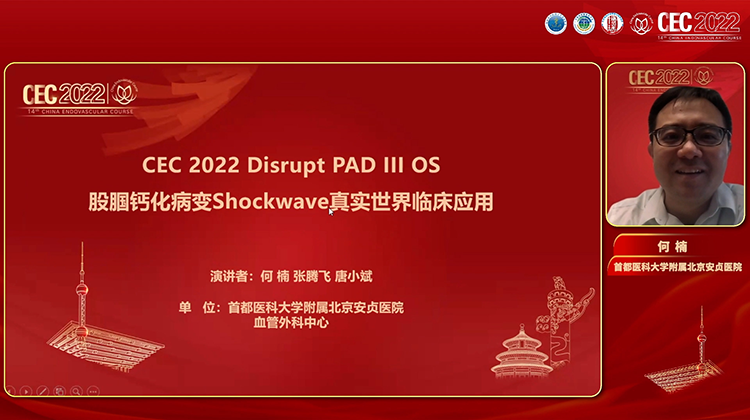 Shockwave IVL在股腘动脉中的应用病例与讨论-何楠