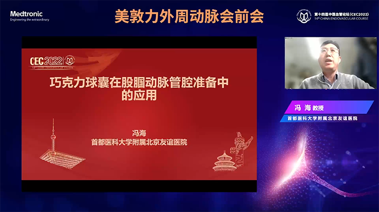 巧克力球囊在股腘动脉管腔准备中的应用-冯海