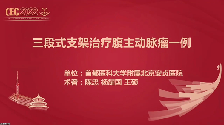 Endurant IIS 三段式支架治疗腹主动脉瘤一例-陈忠 杨耀国
