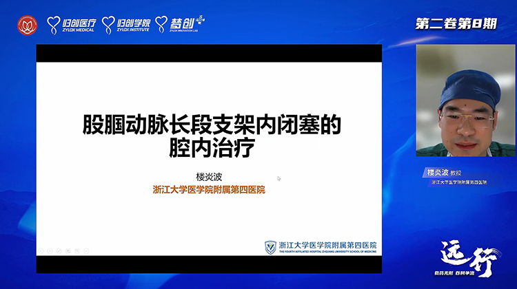 股腘动脉长段支架内闭塞的腔内治疗-楼炎波