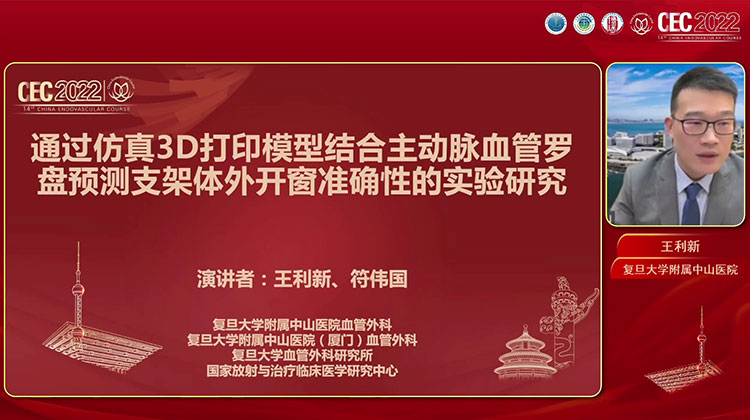 通过仿真3D打印模型结合主动脉血管罗盘预测支架体外开窗准确性的实验研究-王利新