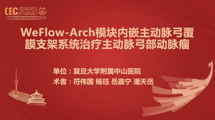 WeFlow-Arch模块内嵌主动脉弓覆膜支架系统治疗主动脉弓部动脉瘤-符伟国